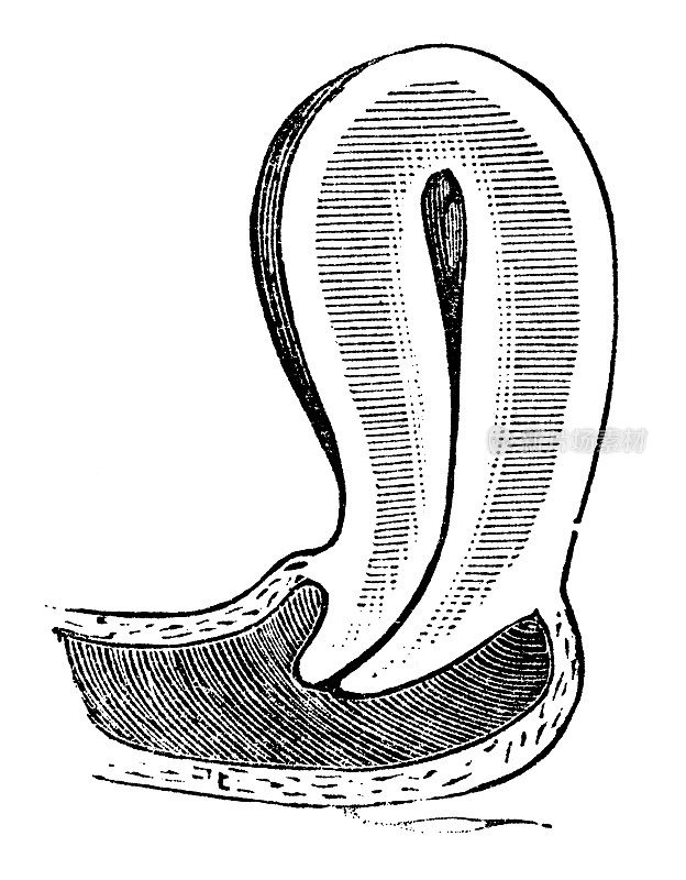 人体子宫的医学插图- 19世纪